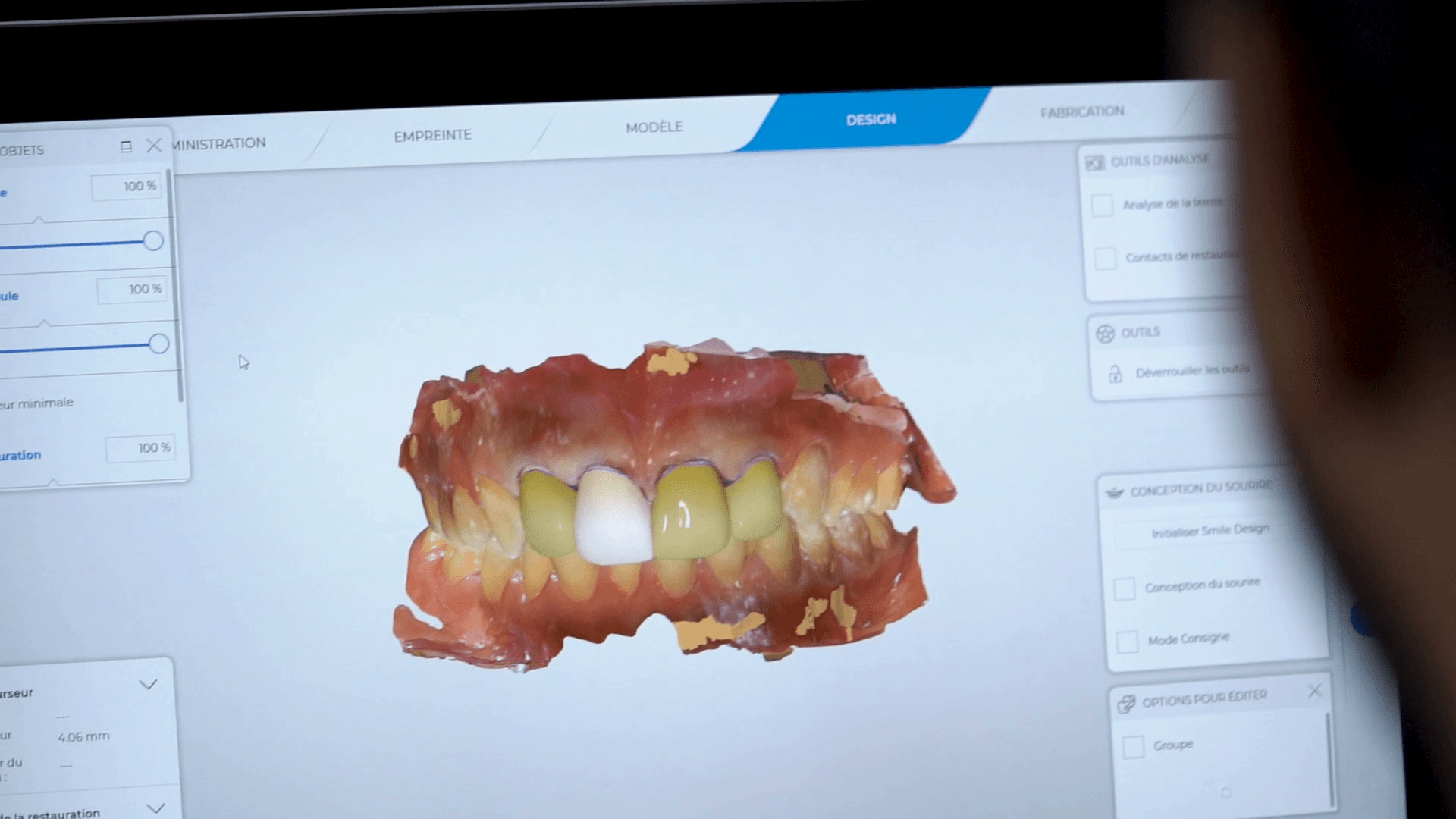 Digital Smile Clinic Mazagan